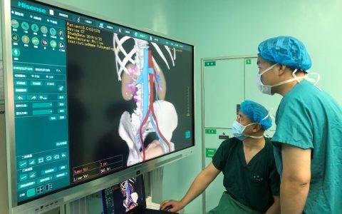 海信助力！山东完成首例“3D+5G” 肾结石微创手术直播