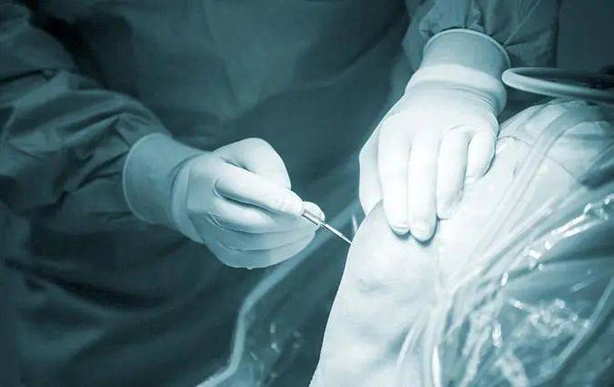 Google、微软工程师花几十万把腿弄断，这件事在硅谷越来越流行