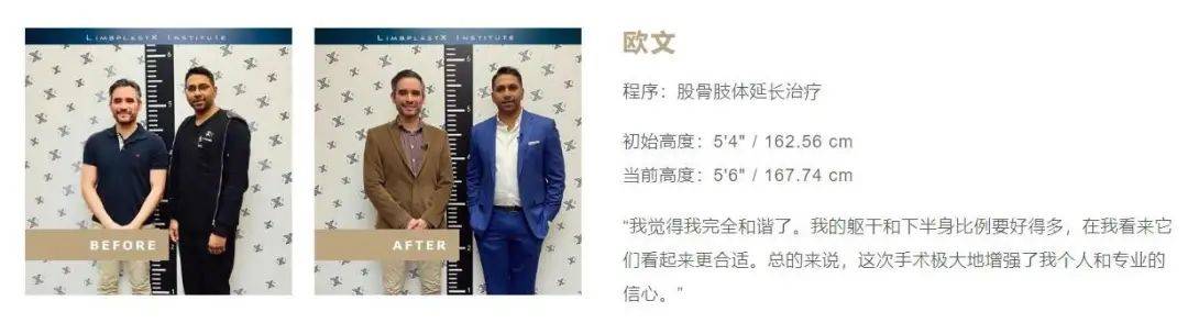 Google、微软工程师花几十万把腿弄断，这件事在硅谷越来越流行