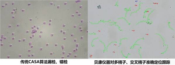 全球首款活精子检测仪器上市！贝康医疗-B（2170.HK）智能精子分析仪有望替代传统CASA诊断模式！